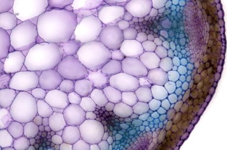 Bild Plant Microbe Interaction